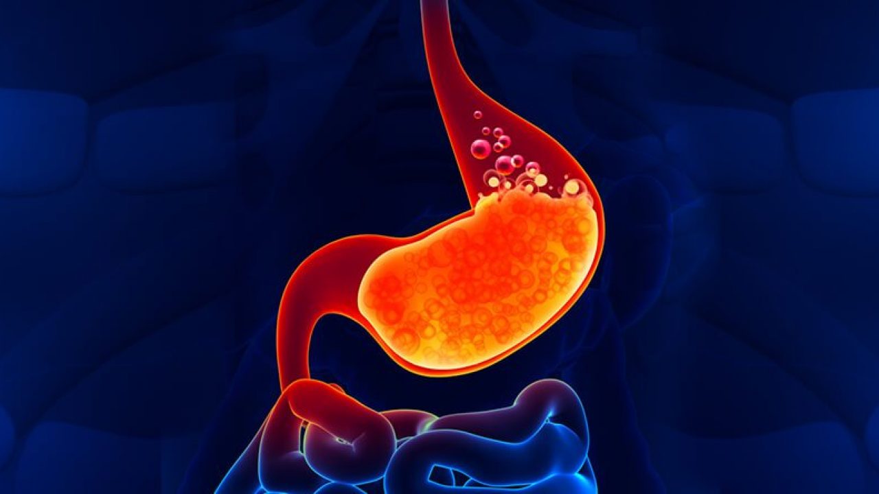 Acid Reflux Disease